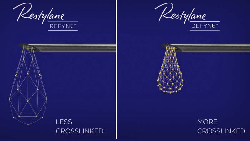 Promotional image of refyne and defyne filler