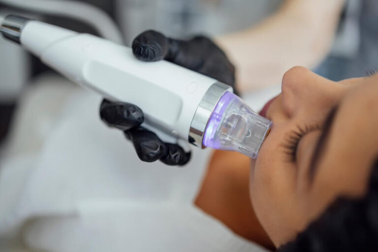 Beautician conducts a facial rejuvenation procedure for a woman