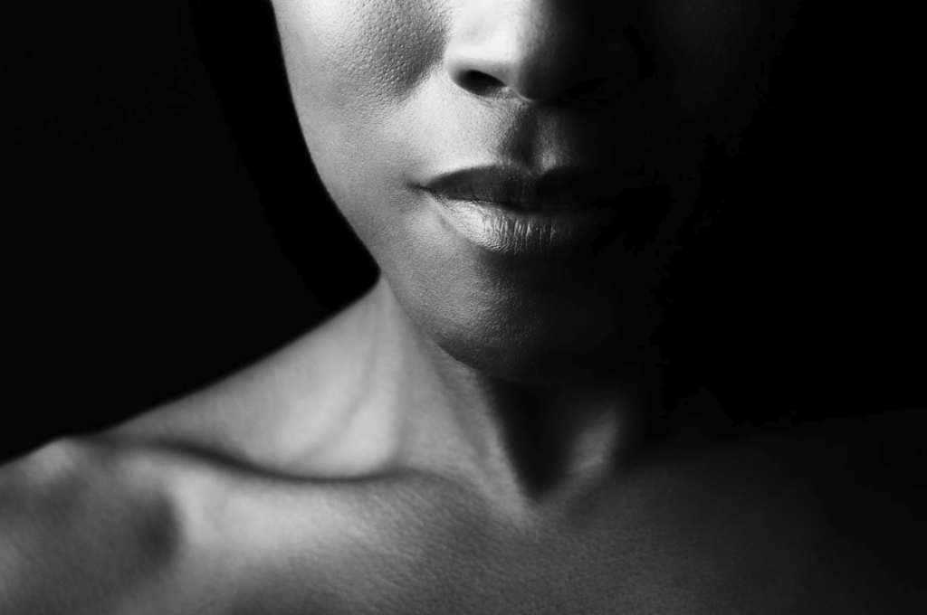 Lip Augmentation After treatment