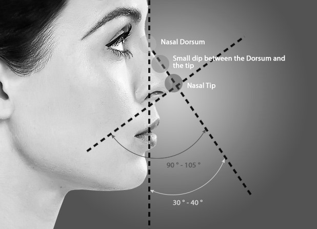 Rhinoplasty treatment Illustration