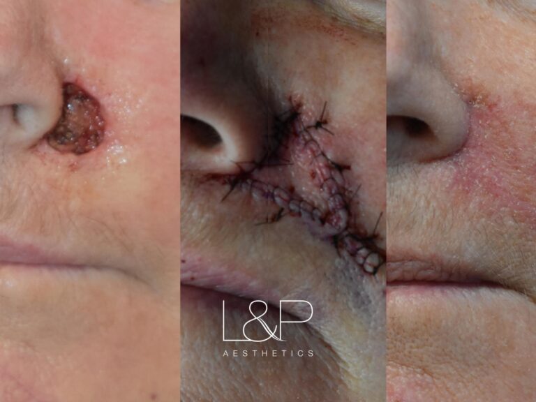 Reconstructive Surgery before and after treatment