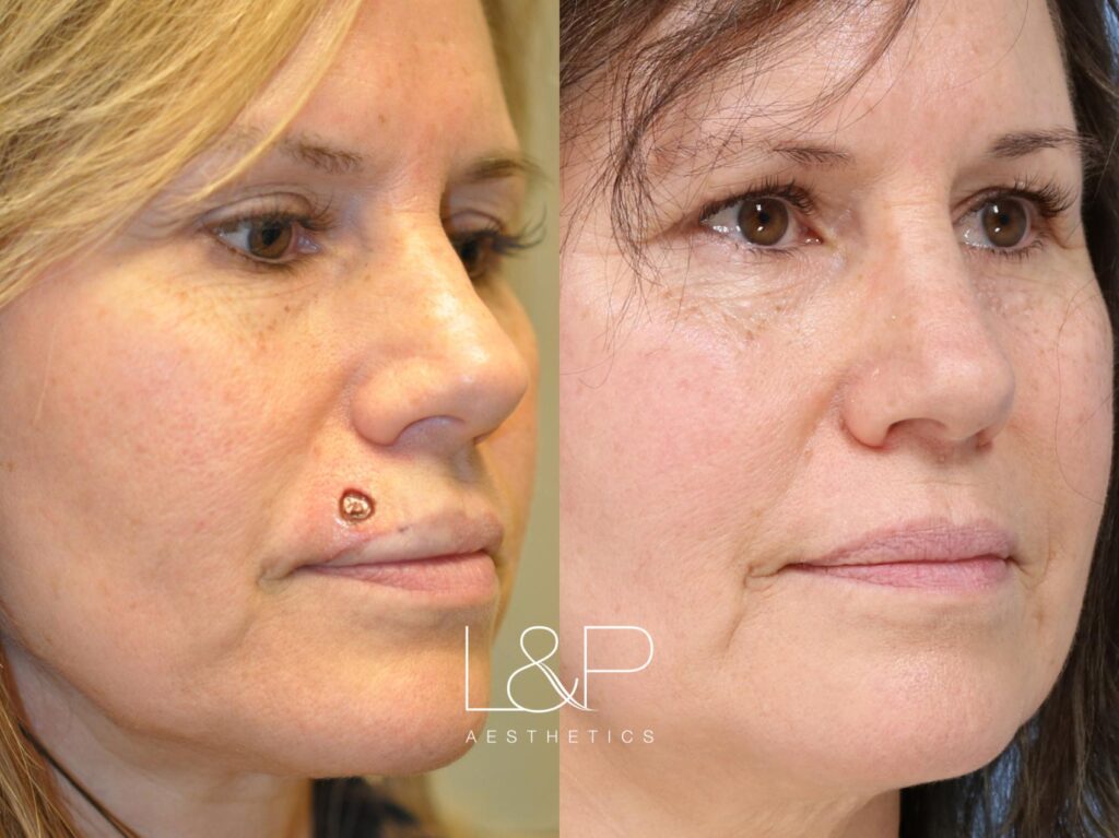 Reconstructive Surgery before and after treatment