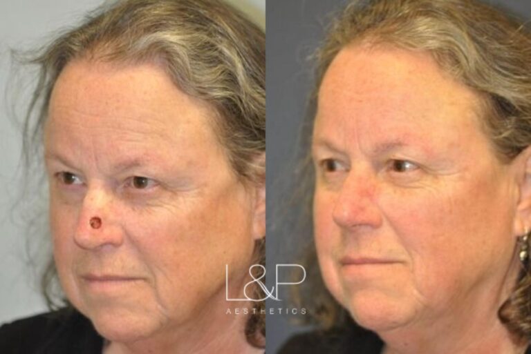 Reconstructive Surgery before and after treatment